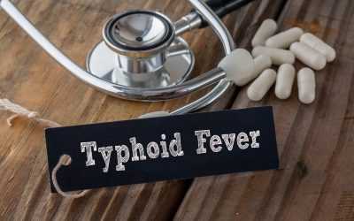 Typhoid